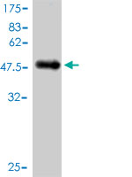 Antibody Reactive Against Recombinant Protein.Western Blot detection against Immunogen (44.66 KDa) . 