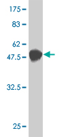 Antibody Reactive Against Recombinant Protein.Western Blot detection against Immunogen (50.71 KDa) . 