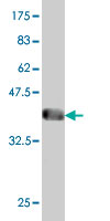 Antibody Reactive Against Recombinant Protein.Western Blot detection against Immunogen (43.78 KDa) . 