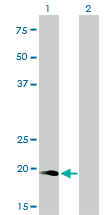 Western Blot analysis of NUDT10 expression in transfected 293T cell line by NUDT10 monoclonal antibody (M01), clone 2F8.Lane 1: NUDT10 transfected lysate(18.5 KDa).Lane 2: Non-transfected lysate.