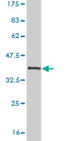 Antibody Reactive Against Recombinant Protein.Western Blot detection against Immunogen (36.63 KDa) . 