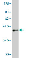 Antibody Reactive Against Recombinant Protein.Western Blot detection against Immunogen (36.74 KDa) . 