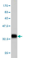 Antibody Reactive Against Recombinant Protein.Western Blot detection against Immunogen (36.74 KDa) . 