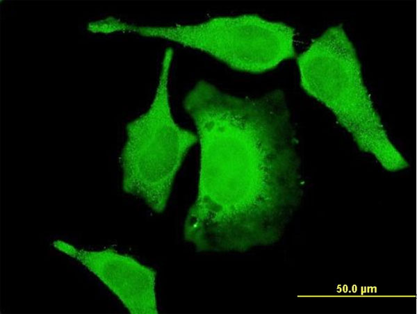 Immunofluorescence of monoclonal antibody to PAN2 on HeLa cell . [antibody concentration 10 ug/ml]