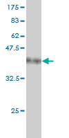 Antibody Reactive Against Recombinant Protein.Western Blot detection against Immunogen (37.84 KDa) . 