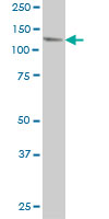 USP48 monoclonal antibody (M01), clone 3G4 Western Blot analysis of USP48 expression in HeLa ( (Cat # AT4494a )