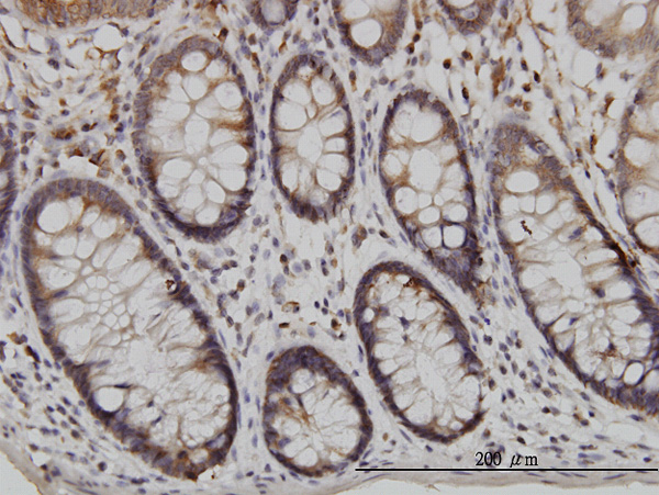 Immunoperoxidase of monoclonal antibody to USP48 on formalin-fixed paraffin-embedded human colon. [antibody concentration 3 ug/ml]