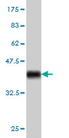 Antibody Reactive Against Recombinant Protein.Western Blot detection against Immunogen (36.63 KDa) . 