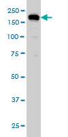 USP47 monoclonal antibody (M01), clone 5F9 Western Blot analysis of USP47 expression in HeLa ( (Cat # AT4493a )
