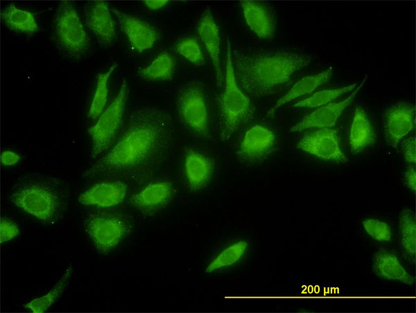 Immunofluorescence of monoclonal antibody to USP47 on HeLa cell. [antibody concentration 10 ug/ml]