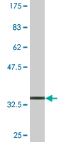 Antibody Reactive Against Recombinant Protein.Western Blot detection against Immunogen (35.75 KDa) . 