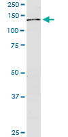 USP45 monoclonal antibody (M01), clone 1H2. Western Blot analysis of USP45 expression in human pancreas.