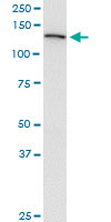USP45 monoclonal antibody (M01), clone 1H2. Western Blot analysis of USP45 expression in HeLa.