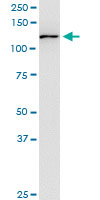 USP45 monoclonal antibody (M01), clone 1H2. Western Blot analysis of USP45 expression in PC-12.