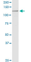 USP45 monoclonal antibody (M01), clone 1H2. Western Blot analysis of USP45 expression in NIH/3T3.