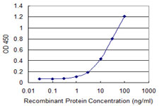 Detection limit for recombinant GST tagged USP45 is 0.3 ng/ml as a capture antibody.