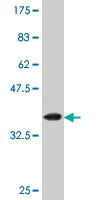 Antibody Reactive Against Recombinant Protein.Western Blot detection against Immunogen (37.62 KDa) .