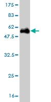 Antibody Reactive Against Recombinant Protein.Western Blot detection against Immunogen (54.89 KDa) . 