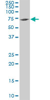 TXNDC3 monoclonal antibody (M01), clone 1G5. Western Blot analysis of TXNDC3 expression in Jurkat ( (Cat # AT4416a )