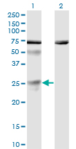 Western Blot analysis of TWSG1 expression in transfected 293T cell line by TWSG1 monoclonal antibody (M01), clone 6E6.Lane 1: TWSG1 transfected lysate(25 KDa).Lane 2: Non-transfected lysate.
