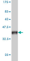 Antibody Reactive Against Recombinant Protein.Western Blot detection against Immunogen (36.74 KDa) . 