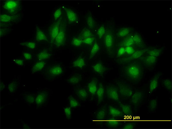 Immunofluorescence of monoclonal antibody to TUBG2 on HeLa cell. [antibody concentration 25 ug/ml]