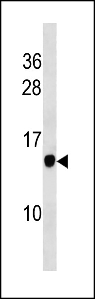 POMP Antibody (C-term) (Cat. #AP20420b) western blot analysis in mouse stomach tissue lysates (35ug/lane).This demonstrates the POMP antibody detected the POMP protein (arrow).