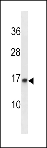 POMP Antibody (C-term) (Cat. #AP20420b) western blot analysis in WiDr cell line lysates (35ug/lane).This demonstrates the POMP antibody detected the POMP protein (arrow).