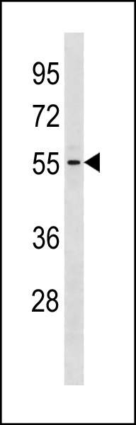 GTDC1 Antibody (Center) (Cat. #AP20381c) western blot analysis in Jurkat cell line lysates (35ug/lane).This demonstrates the GTDC1 antibody detected the GTDC1 protein (arrow).