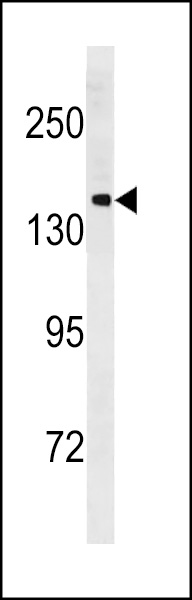PCDH11Y Antibody (C-term) (Cat. #AP20352b) western blot analysis in NCI-H292 cell line lysates (35ug/lane).This demonstrates the PCDH11Y antibody detected the PCDH11Y protein (arrow).