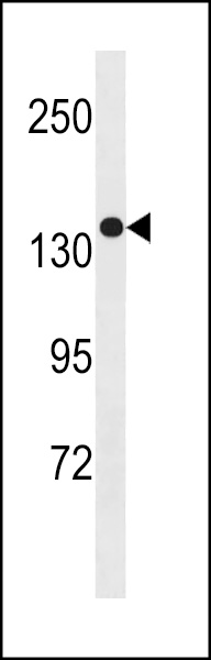 SGSM1 Antibody (Center) (Cat. #AP20344c) western blot analysis in MDA-MB453 cell line lysates (35ug/lane).This demonstrates the SGSM1 antibody detected the SGSM1 protein (arrow).