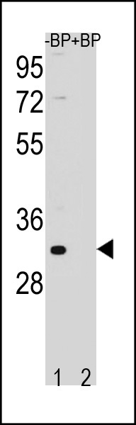Western blot analysis of FAM26F Antibody (C-term) Pab (Cat. #AP20331b) pre-incubated without(lane 1) and with(lane 2) blocking peptide in NCI-H460 cell line lysate. FAM26F Antibody (C-term) (arrow) was detected using the purified Pab.
