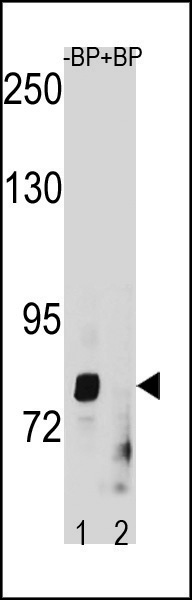 ZMAT1 Antibody (C-term) (Cat. #AP20320b) western blot analysis in HepG2 cell line lysates (35ug/lane).This demonstrates the ZMAT1 antibody detected the ZMAT1 protein (arrow).