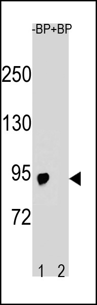 Western blot analysis of SLCO6A1 Antibody (C-term) Pab (Cat. #AP20316b) pre-incubated without(lane 1) and with(lane 2) blocking peptide in A2058 cell line lysate. SLCO6A1 Antibody (C-term) (arrow) was detected using the purified Pab.