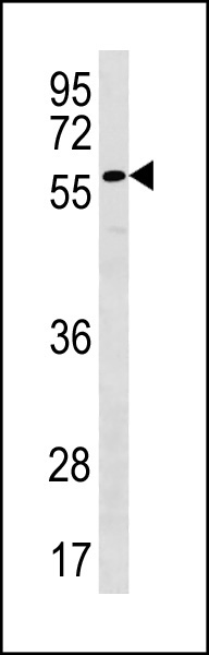 PLXDC2 Antibody (N-term) (Cat. #AP20309a) western blot analysis in NCI-H292 cell line lysates (35ug/lane).This demonstrates the PLXDC2 antibody detected the PLXDC2 protein (arrow).