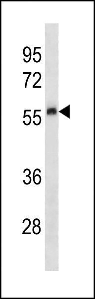 Mouse Plau Antibody (C-term) (Cat. #AP20302b) western blot analysis in human placenta tissue lysates (35ug/lane).This demonstrates the Mouse Plau antibody detected the Mouse Plau protein (arrow).