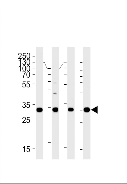 HOXB2 Antibody (C-term) (Cat. #AP20543b) western blot analysis in Hela,SiHa,U251,U87-MG cell line lysates (35ug/lane).This demonstrates the HOXB2 antibody detected the HOXB2 protein (arrow).