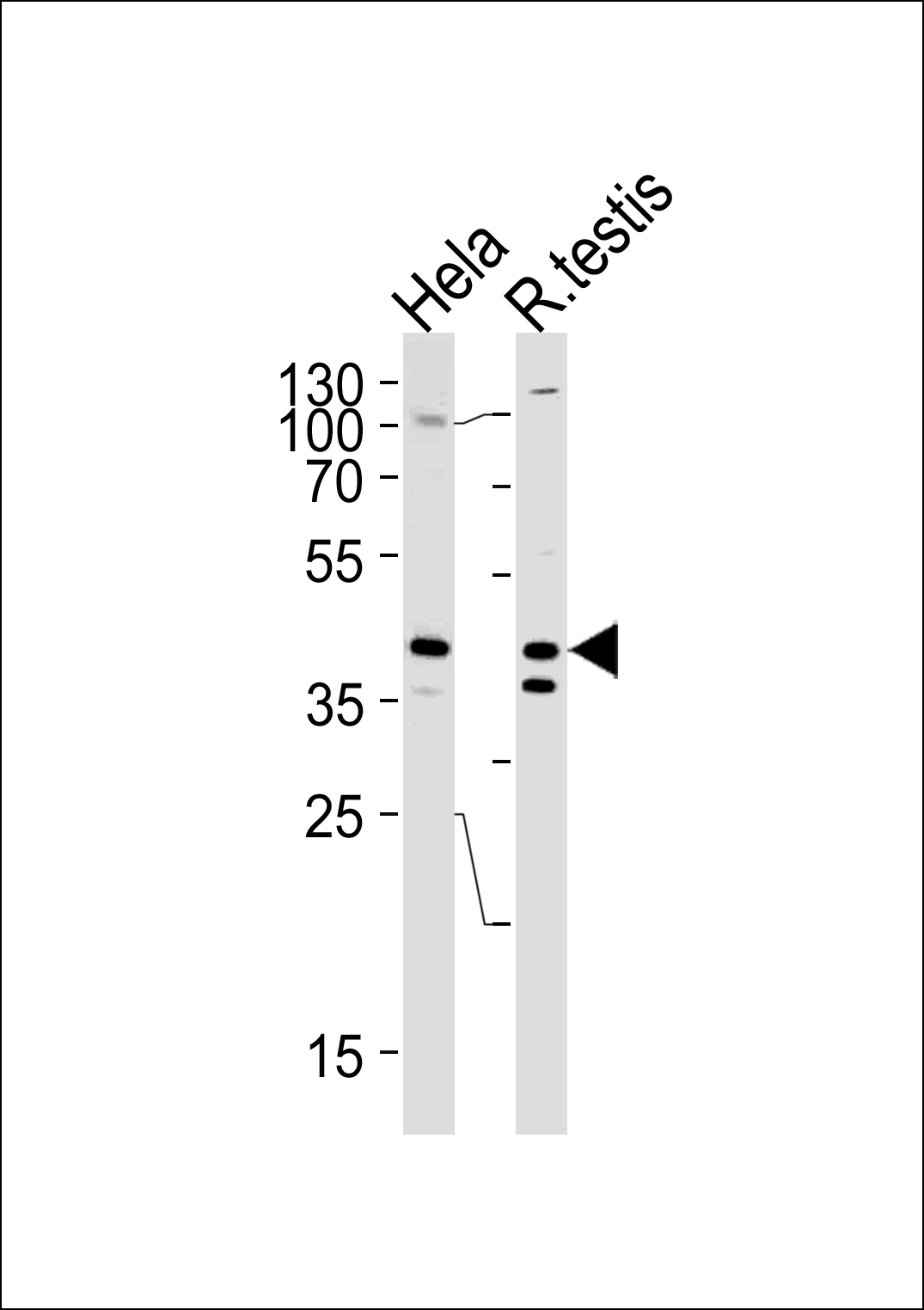 KHDRBS2 Antibody (C-term) (Cat. #AP20541b) western blot analysis in Hela cell line and rat testis tissue lysates (35ug/lane).This demonstrates the KHDRBS2 antibody detected the KHDRBS2 protein (arrow).