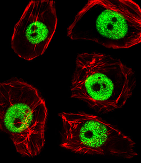 Fluorescent image of MDA-MB468 cells stained with TPD52L3 Antibody (N-term)(Cat#AP20505A). AP20505A was diluted at 1:25 dilution. An Alexa Fluor 488-conjugated goat anti-rabbit lgG at 1:400 dilution was used as the secondary antibody (green). Cytoplasmic actin was counterstained with Alexa Fluor® 555 conjugated with Phalloidin (red).