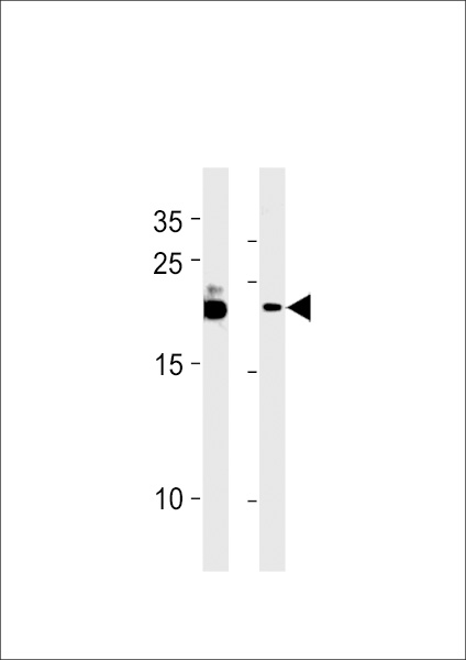 C13orf30 Antibody (C-term) (Cat. #AP20501b) western blot analysis in B-3,MCF-7 cell line lysates (35ug/lane).This demonstrates the C13orf30 antibody detected the C13orf30 protein (arrow).