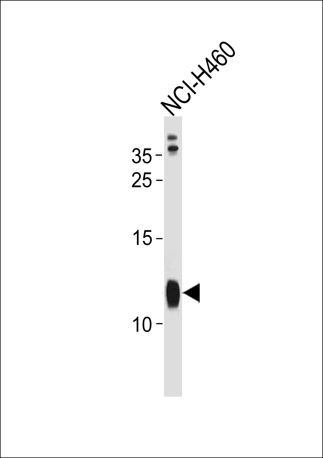 RPS21 Antibody (C-term) (Cat. #AP20470b) western blot analysis in NCI-H460 cell line lysates (35ug/lane).This demonstrates the RPS21 antibody detected the RPS21 protein (arrow).
