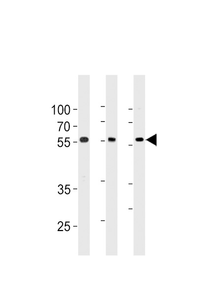 TRIM6 Antibody (N-term) (Cat. #AP20469a) western blot analysis in 293,A549,Ramos cell line lysates (35ug/lane).This demonstrates the TRIM6 antibody detected the TRIM6 protein (arrow).
