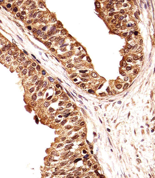 Immunohistochemical analysis of paraffin-embedded H. prostate section using ECE2 Antibody (Center)(Cat#AP20460C). AP20460C was diluted at 1:25 dilution. A undiluted biotinylated goat polyvalent antibody was used as the secondary, followed by DAB staining.