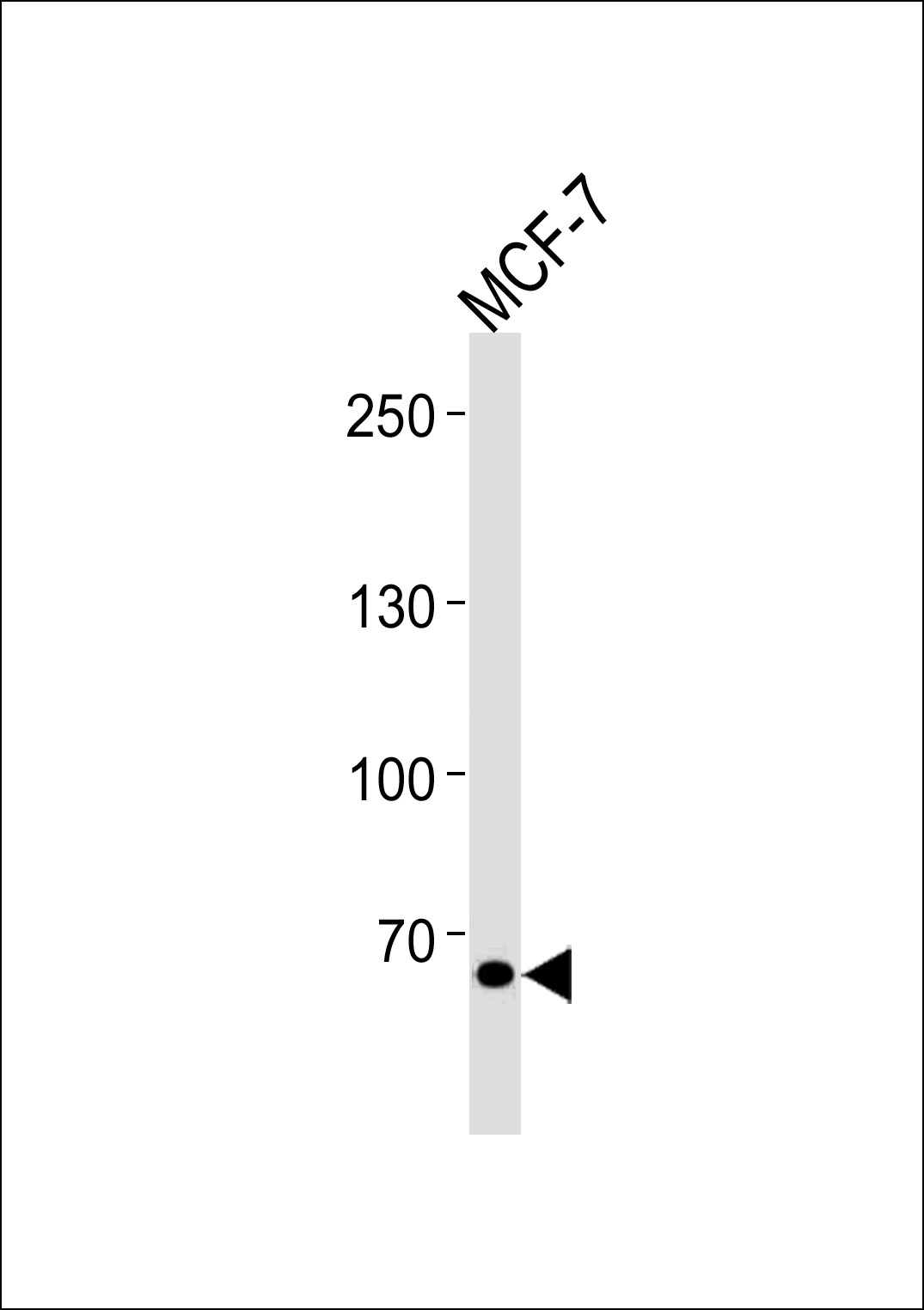 TSPYL2 Antibody (Center) (Cat. #AP20456c) western blot analysis in MCF-7 cell line lysates (35ug/lane).This demonstrates the TSPYL2 antibody detected the TSPYL2 protein (arrow).