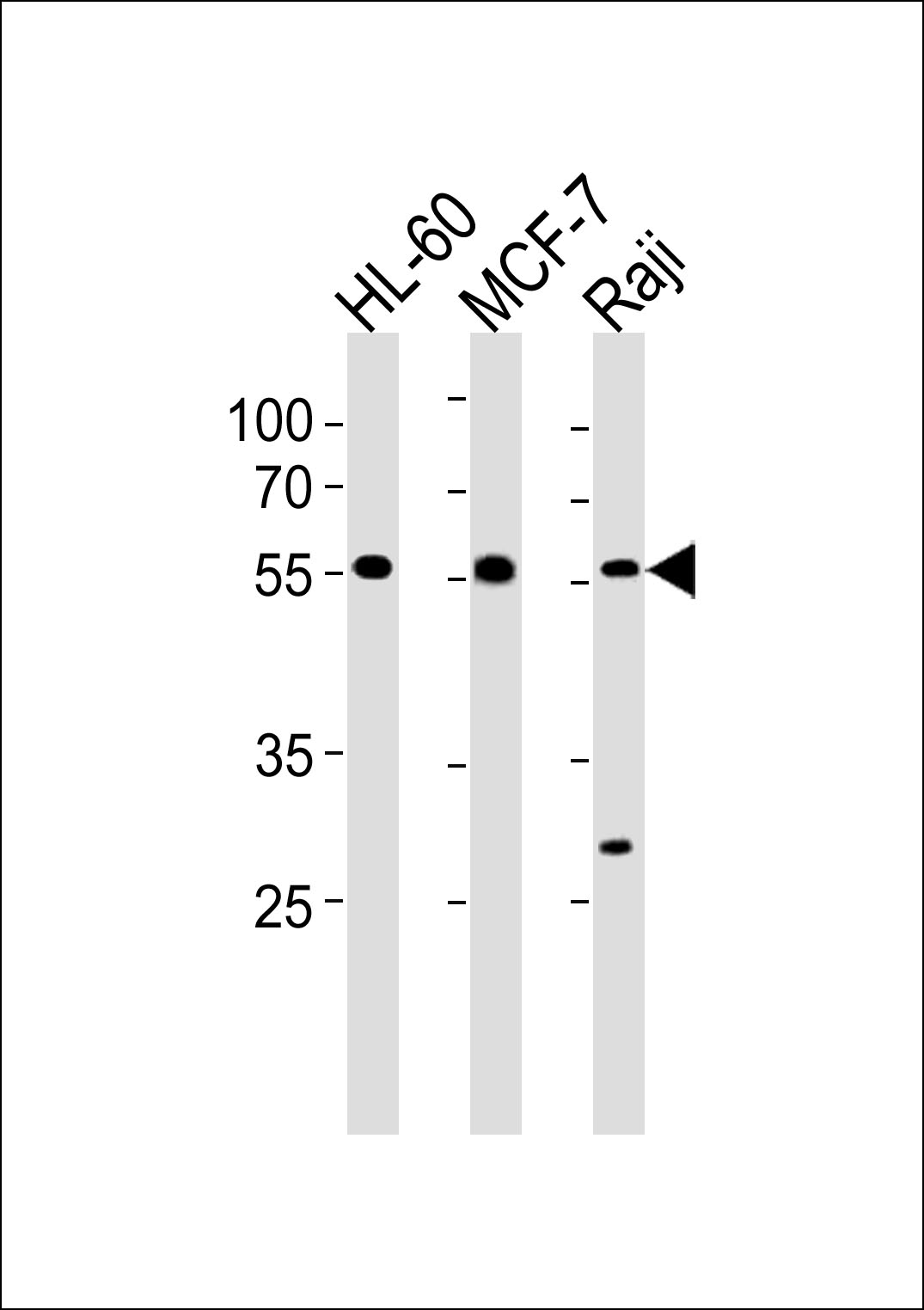 C16orf71 Antibody (Center) (Cat. #AP20434c) western blot analysis in HL-60,MCF-7 and Raji cell line lysates (35ug/lane).This demonstrates the C16orf71 antibody detected the C16orf71 protein (arrow).