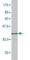 Antibody Reactive Against Recombinant Protein.Western Blot detection against Immunogen (36.63 KDa) . 