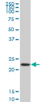 RPS5 monoclonal antibody (M02), clone 4H3 Western Blot analysis of RPS5 expression in HeLa ( (Cat # AT3719a )