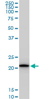 RPS5 monoclonal antibody (M02), clone 4H3. Western Blot analysis of RPS5 expression in PC-12((Cat # AT3719a )