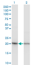 Western Blot analysis of RPS5 expression in transfected 293T cell line by RPS5 monoclonal antibody (M02), clone 4H3.Lane 1: RPS5 transfected lysate(22.9 KDa).Lane 2: Non-transfected lysate.