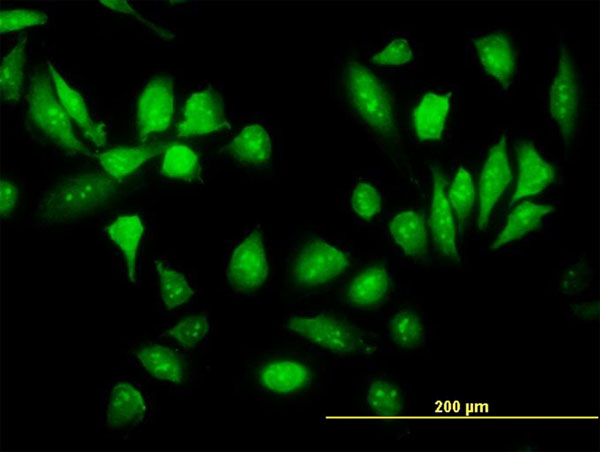 Immunofluorescence of monoclonal antibody to RPS5 on HeLa cell. [antibody concentration 10 ug/ml]